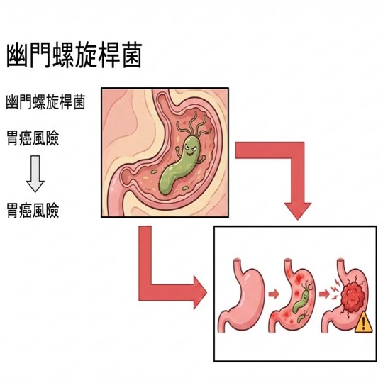 預防胃癌？從殺菌作起～