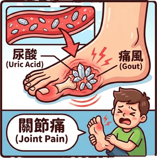 尿酸太高，小心痛風找上門！
